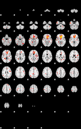 Patient:73;component:120