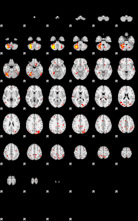 Patient:73;component:130