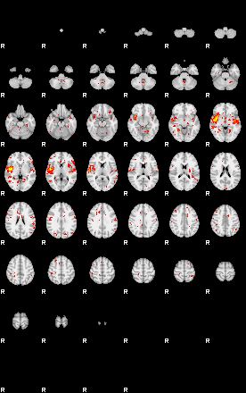 Patient:73;component:58