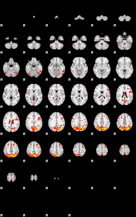 Patient:74;component:109