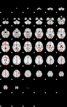 Patient:74;component:111