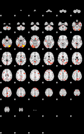 Patient:74;component:122