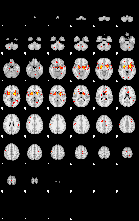 Patient:74;component:129