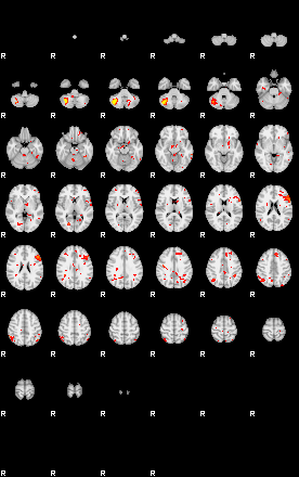 Patient:74;component:130