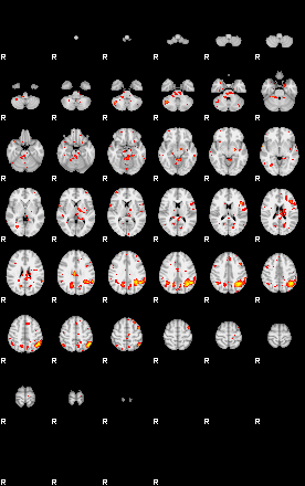 Patient:74;component:14