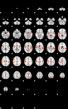 Patient:74;component:150