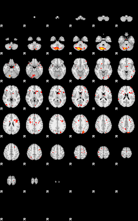 Patient:74;component:154