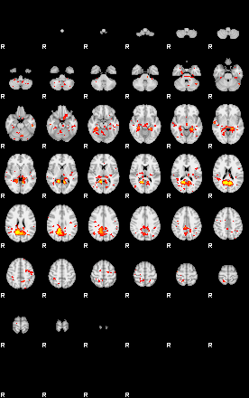 Patient:74;component:161