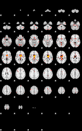 Patient:74;component:174