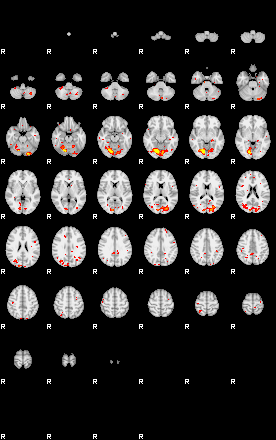 Patient:74;component:191