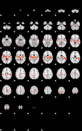 Patient:74;component:39