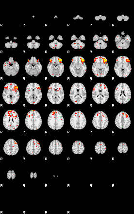 Patient:74;component:42