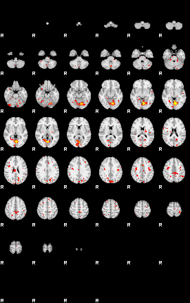 Patient:74;component:51