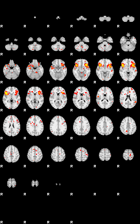 Patient:74;component:52