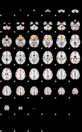 Patient:75;component:113