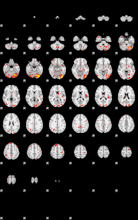 Patient:75;component:122