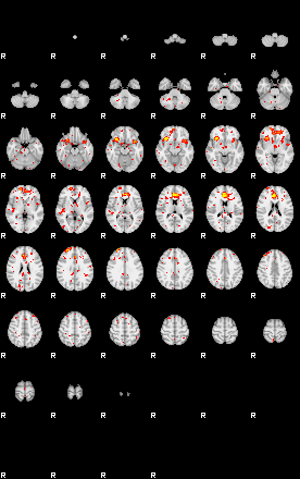 Patient:75;component:125