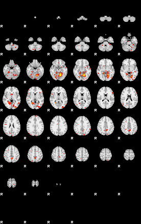 Patient:75;component:132