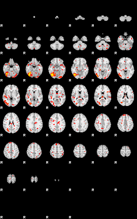 Patient:75;component:143