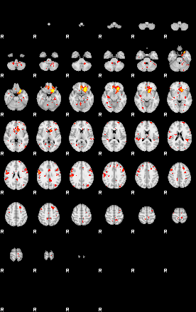 Patient:75;component:144