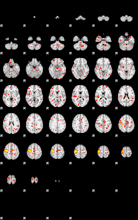 Patient:75;component:15