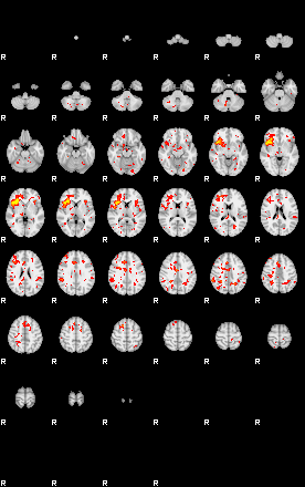 Patient:75;component:151