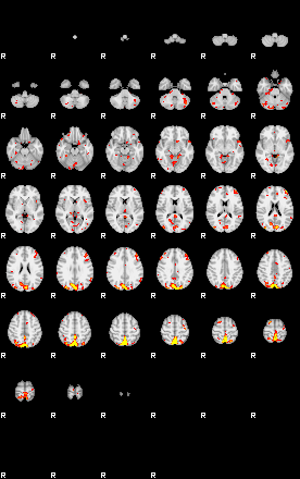 Patient:75;component:166