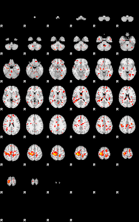 Patient:75;component:178