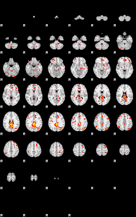 Patient:75;component:180