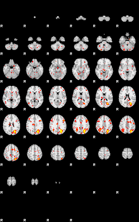 Patient:75;component:183