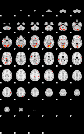 Patient:75;component:191