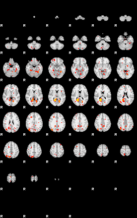 Patient:75;component:29