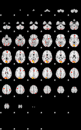 Patient:75;component:30