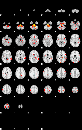 Patient:75;component:32