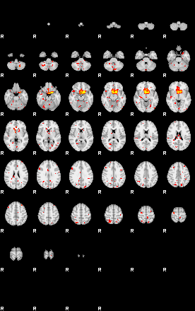 Patient:75;component:43