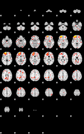 Patient:75;component:48