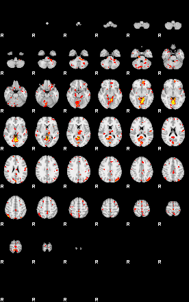 Patient:75;component:51