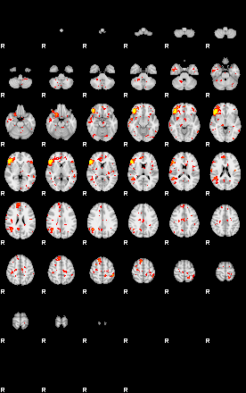 Patient:75;component:6