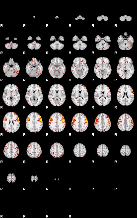 Patient:75;component:60