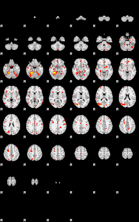 Patient:75;component:82