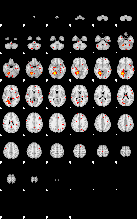 Patient:75;component:88