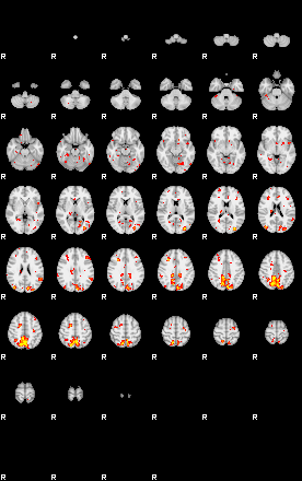 Patient:75;component:91