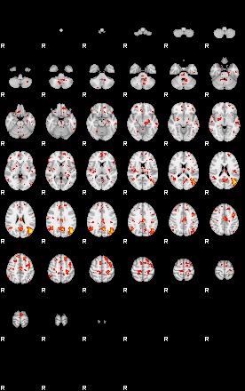 Patient:75;component:93