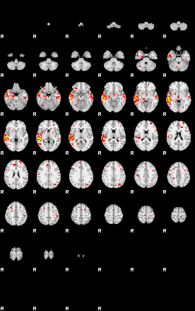 Patient:75;component:98