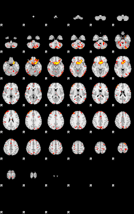 Patient:7;component:43