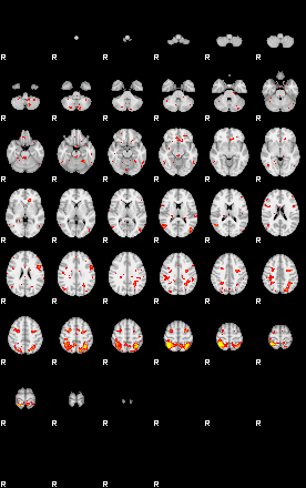 Patient:7;component:55