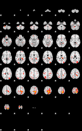 Patient:8;component:55