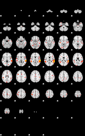 Patient:8;component:56